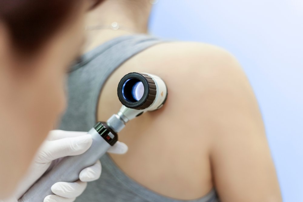 Best Skin Doctor in Dubai