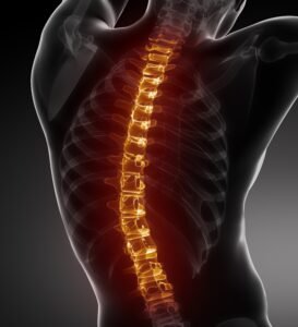 Spine Surgery Dubai