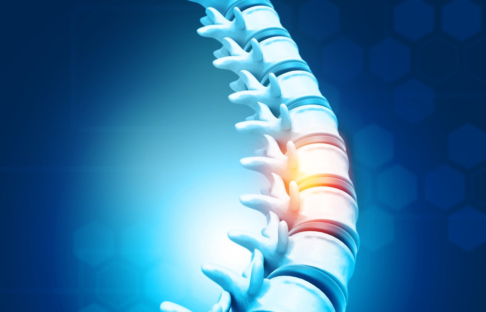Spine Surgery