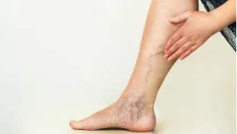 Vein Clinic