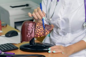 Liver Doctor Dubai