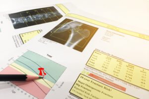 Dexa Scan Dubai