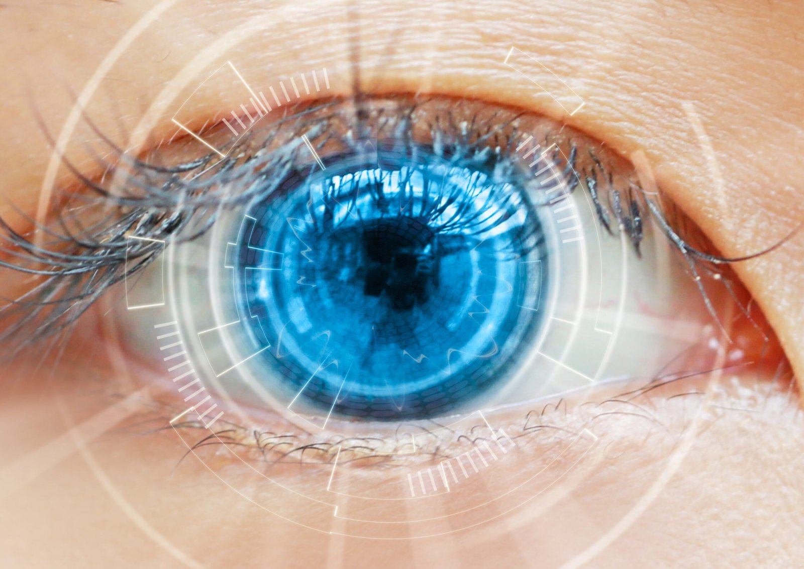 Lasik Eye Surgery (Femto-Lasik) Package