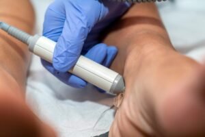 PAD Treatment Dubai