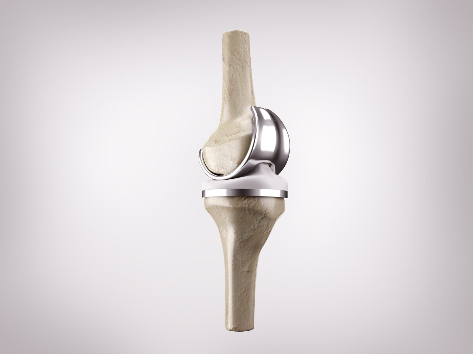 Knee Replacement Surgery Package