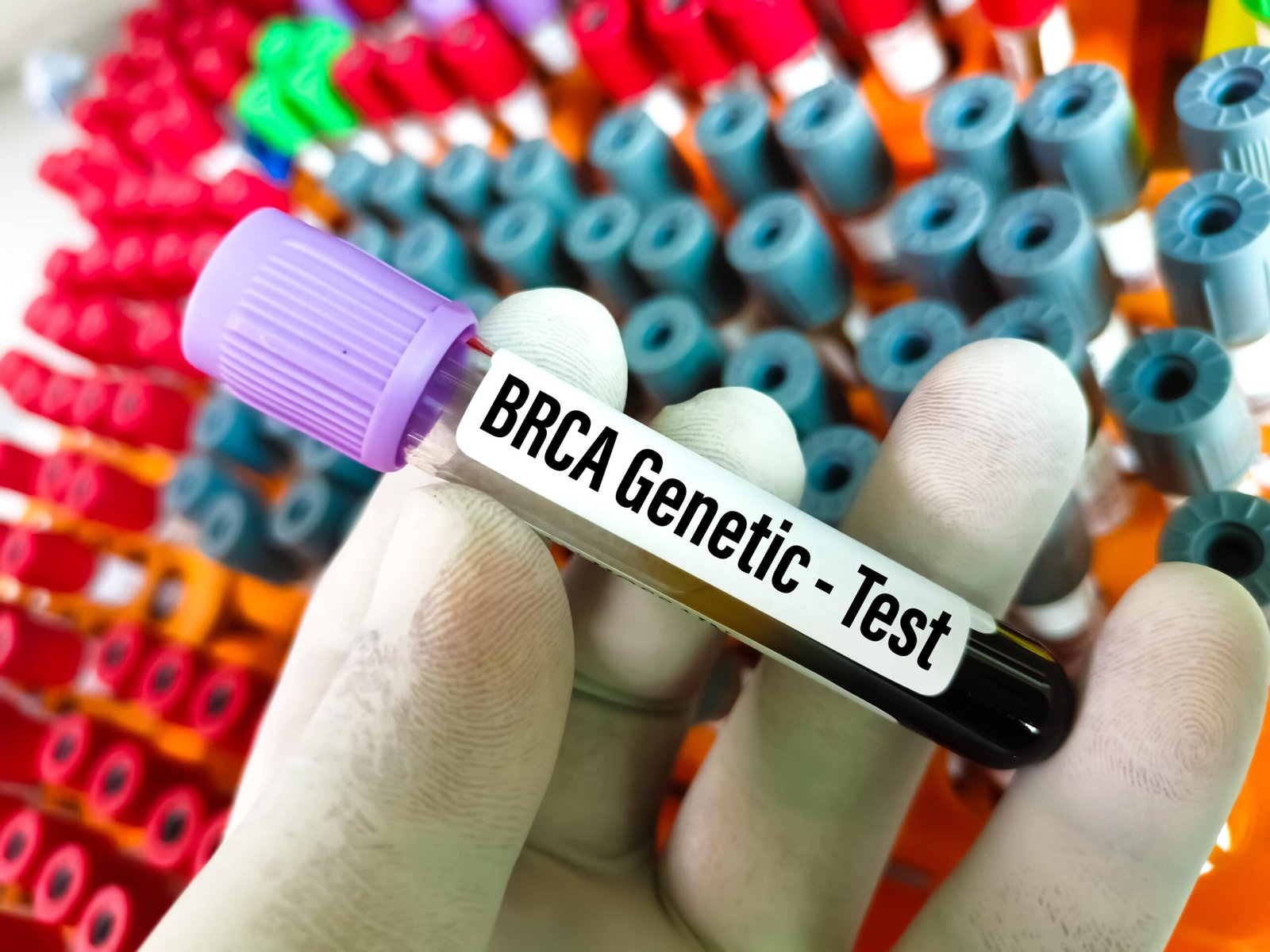 Breast Cancer Genetic Test (BRCA Genetic Test)