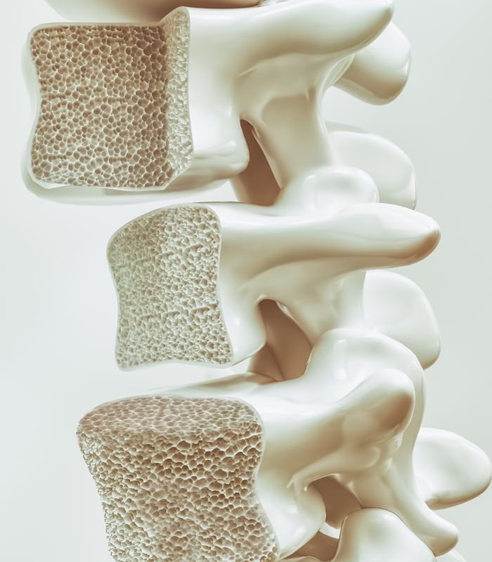 Osteoporosis Screening Package