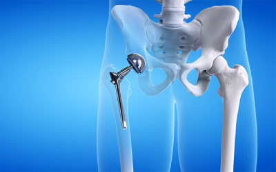 Orthopedic Surgery