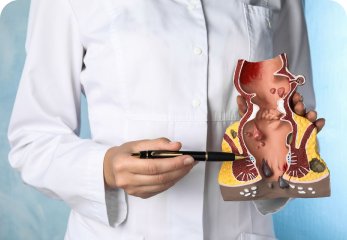 Anal Diseases