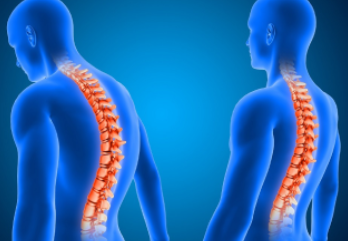 Spine-Surgery