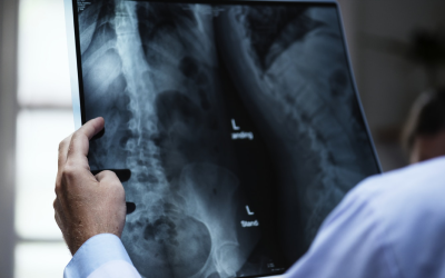 X-ray